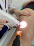 inovacao-no-tratamento-de-varizes:-laser-transdermico-e-escleroterapia